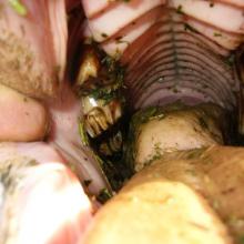 Patient with irregular bite